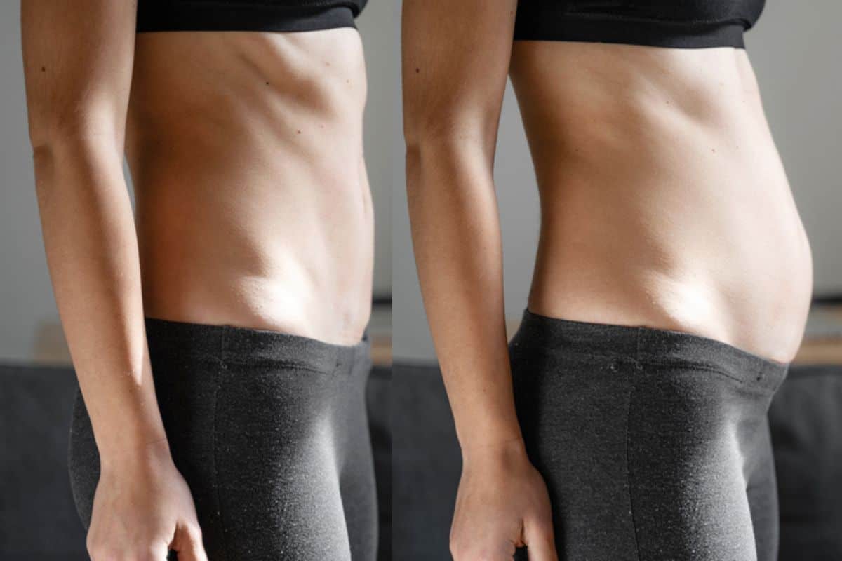 How long does diastasis recti take to improve Palmers Green?