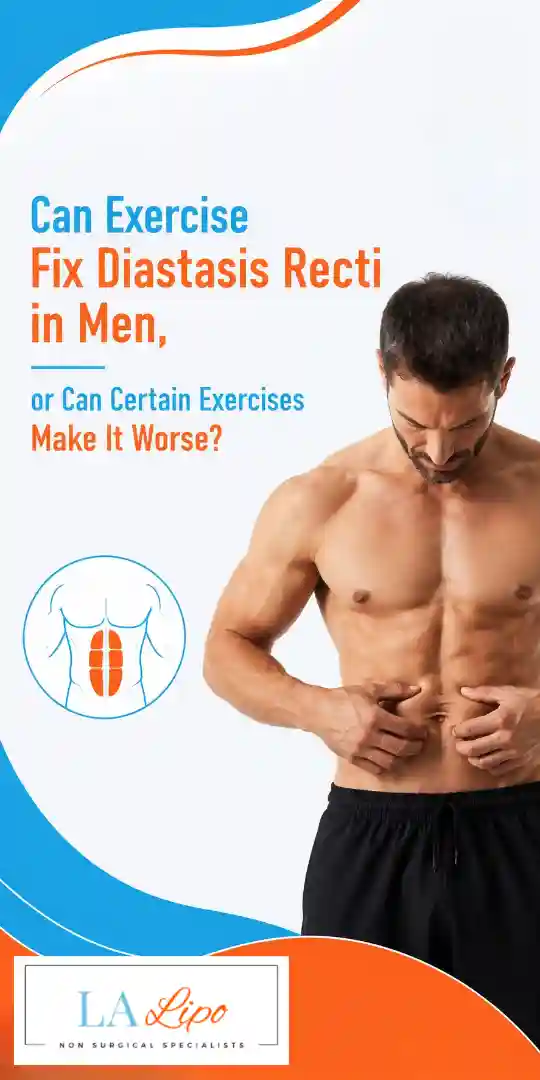 Can Exercise Fix Diastasis Recti in Men, or Can Certain Exercises Make It Worse Palmers Green?