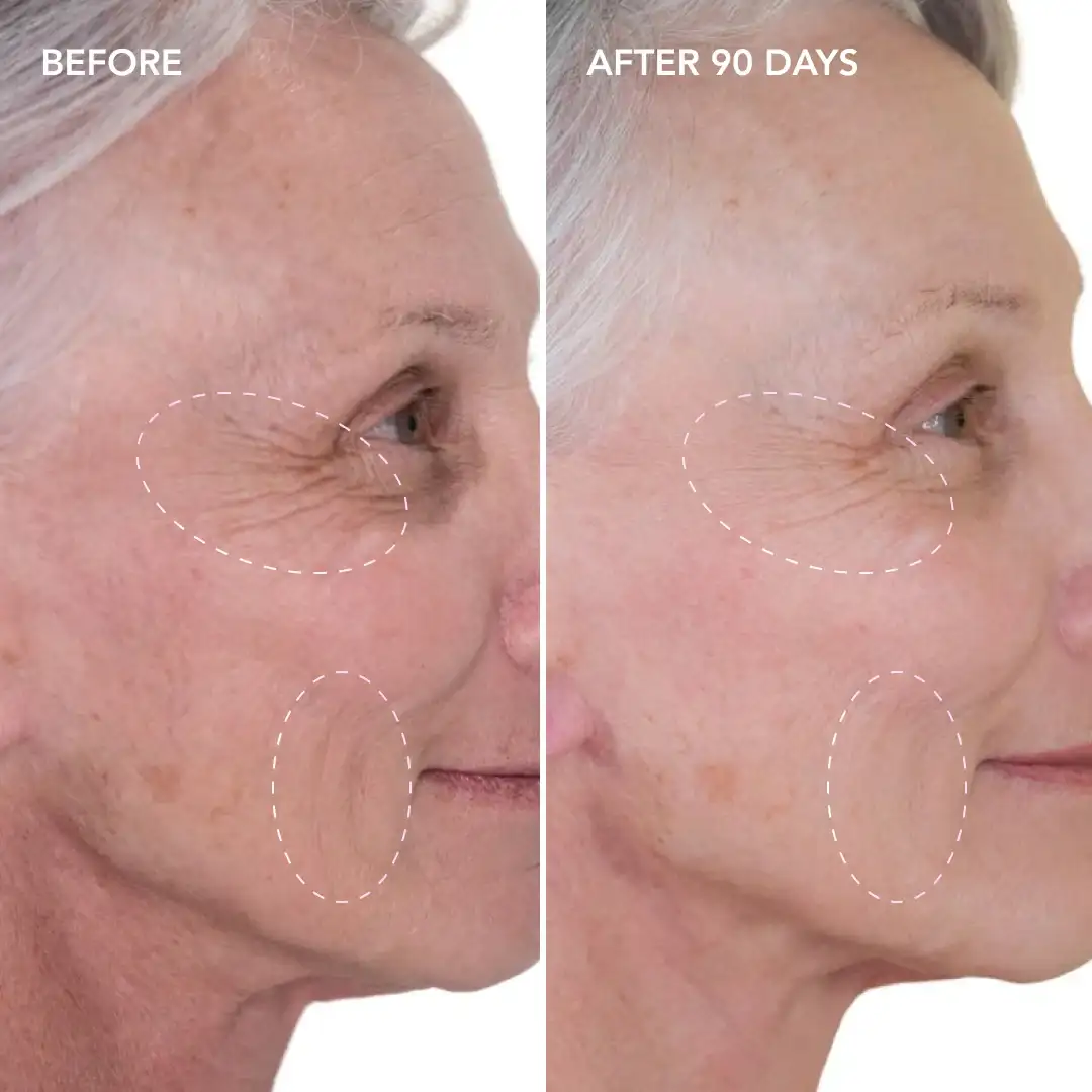 When will you see results Palmers Green